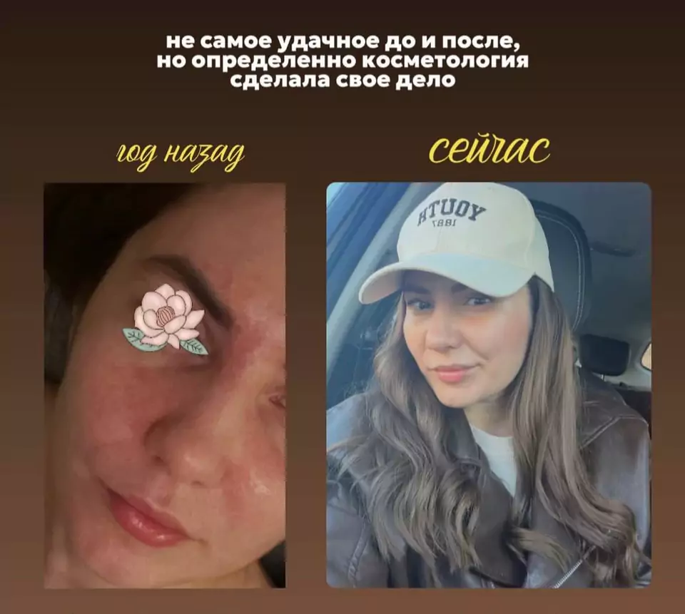 Результат уходовых процедур, материал 1