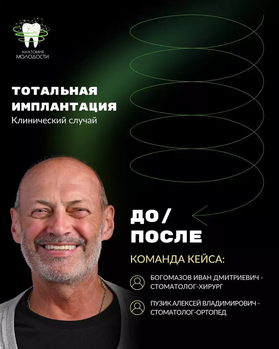 Удаление зубов, имплантация и съёмный протез, материал 1